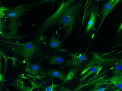 Skeletal stem cells